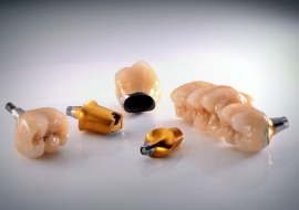 Implants_A-Implant Crowns and Bridge
