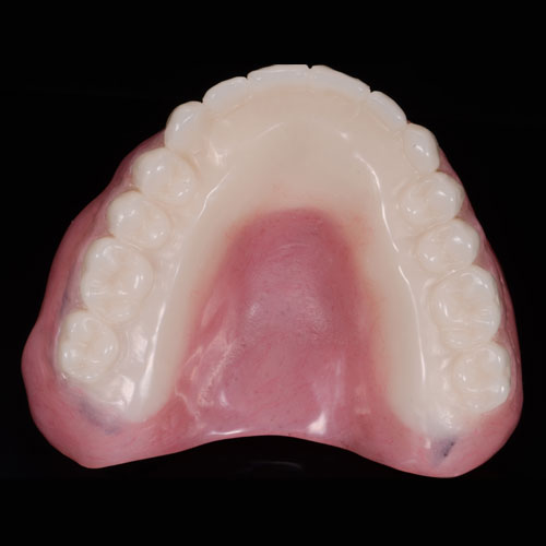 Chairside Conversion Denture Occlusal Thumb